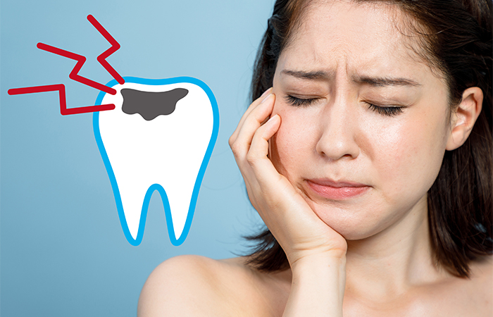 むし歯治療は早めが肝心